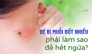 Bé bị muỗi đốt nhiều phải làm sao để hết ngứa?
