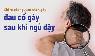 Chỉ rõ các nguyên nhân gây đau cổ gáy sau khi ngủ dậy