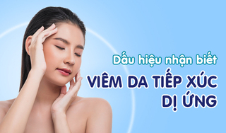 Dấu hiệu nhận biết viêm da tiếp xúc dị ứng phổ biến nhất