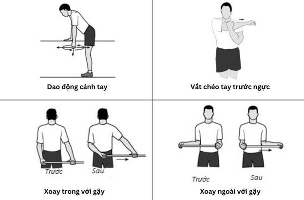 Các triệu chứng, biện pháp giảm đau viêm quanh khớp vai thể đông cứng