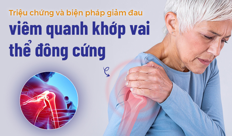 Các triệu chứng, biện pháp giảm đau viêm quanh khớp vai thể đông cứng