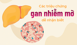 Các triệu chứng gan nhiễm mỡ dễ nhận biết