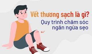 Vết thương sạch là gì? Quy trình chăm sóc ngăn ngừa sẹo