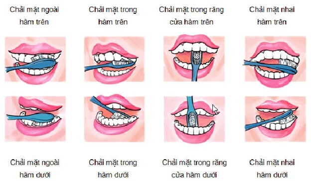 Nhiệt miệng sưng lợi: Làm thế nào để xử trí nhanh chóng?