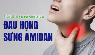 Nhận biết rõ các nguyên nhân gây đau họng sưng amidan