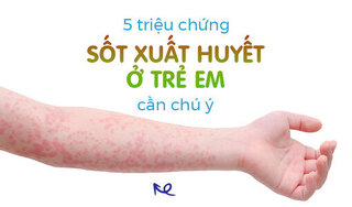5 triệu chứng sốt xuất huyết ở trẻ em cần chú ý