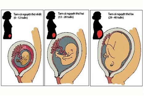 Bị chướng bụng khi mang thai: Mách mẹ các biện pháp cải thiện