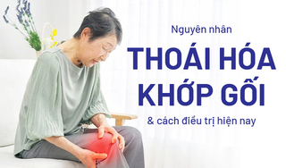 Nguyên nhân thoái hóa khớp gối và cách điều trị hiện nay