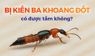 Tư vấn: Bị kiến ba khoang đốt có được tắm không?