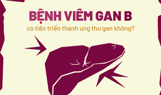 Giải đáp nhanh: Bệnh viêm gan B có tiến triển thành ung thư gan không