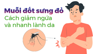 Muỗi đốt sưng đỏ: Cách giảm ngứa và nhanh lành da