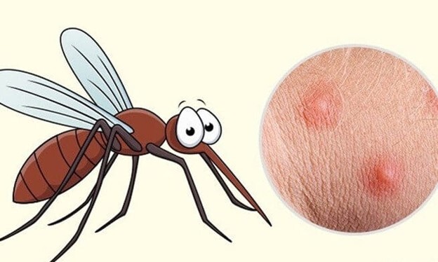 Muỗi đốt sưng đỏ: Cách giảm ngứa và nhanh lành da