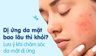 Dị ứng da mặt bao lâu thì khỏi Những lưu ý khi chăm sóc da mặt dị ứng