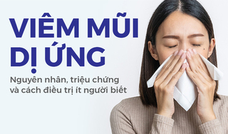 Viêm mũi dị ứng: Nguyên nhân, triệu chứng và cách điều trị