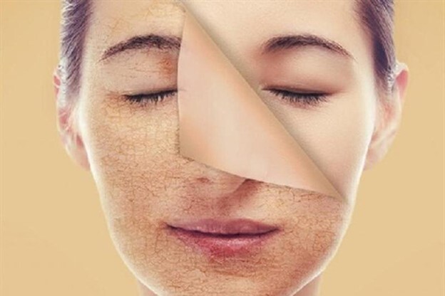 Tìm hiểu: Tẩy tế bào chết đúng cách để có làn da đẹp