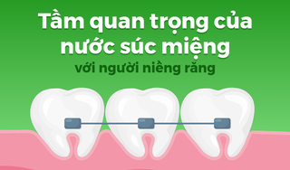 Tầm quan trọng của nước súc miệng với người niềng răng