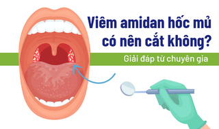 Viêm amidan hốc mủ có nên cắt không: Giải đáp từ chuyên gia