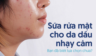 Sữa rửa mặt cho da dầu nhạy cảm: Bạn đã biết lựa chọn chưa?