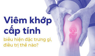 Viêm khớp cấp tính có biểu hiện đặc trưng gì, điều trị thế nào?