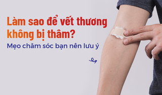 Làm sao để vết thương không bị thâm? Mẹo chăm sóc bạn nên lưu ý