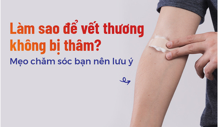 Làm sao để vết thương không bị thâm? Mẹo chăm sóc bạn nên lưu ý