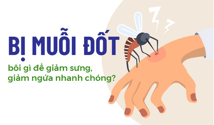 Con bị muỗi đốt bôi gì để giảm sưng, giảm ngứa nhanh chóng?