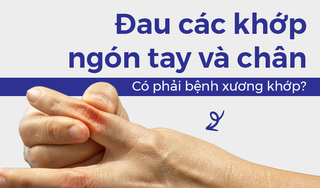 Đau các khớp ngón tay và chân: Có phải bệnh xương khớp?