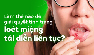 Làm thế nào để giải quyết tình trạng loét miệng tái diễn liên tục?