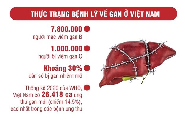 Những nguyên nhân gây bệnh gan và biện pháp bảo vệ gan