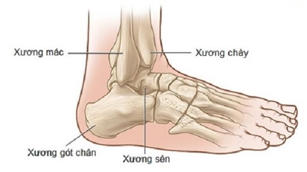 Đau xương gót chân là bệnh gì? Các biện pháp điều trị đau gót chân