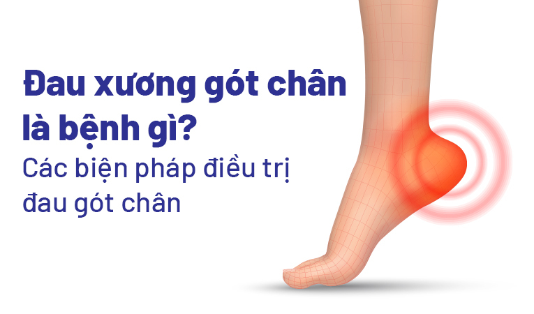 Đau xương gót chân là bệnh gì? Các biện pháp điều trị đau gót chân