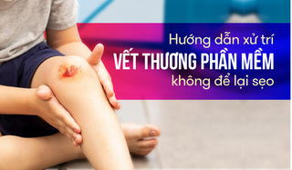 Hướng dẫn xử trí vết thương phần mềm không để lại sẹo