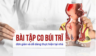 Các bài tập co búi trĩ đơn giản và dễ dàng thực hiện tại nhà