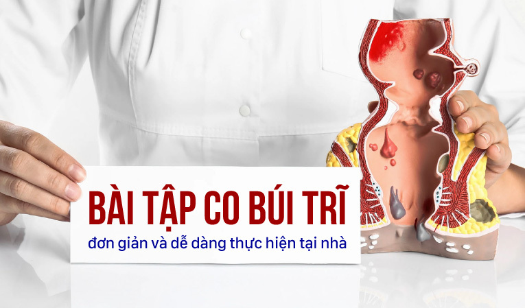 Các bài tập co búi trĩ đơn giản và dễ dàng thực hiện tại nhà