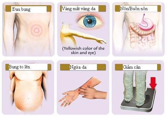 Ung thư gan đa ổ sống được bao lâu? Cách phòng tránh ung thư gan