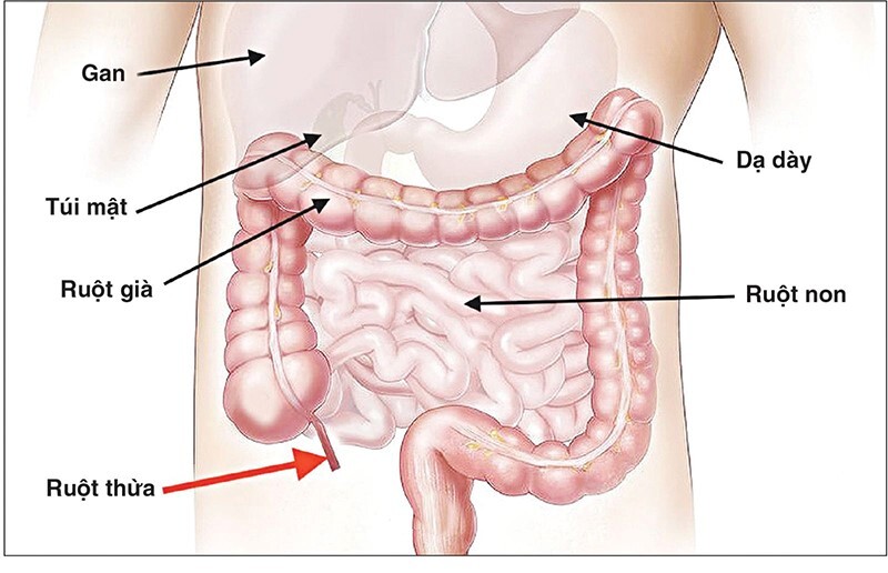 Đau bụng xung quanh rốn: Cảnh báo bệnh lý gì?