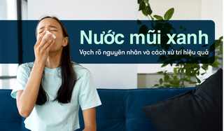 Nước mũi xanh: Vạch rõ nguyên nhân và cách xử trí hiệu quả