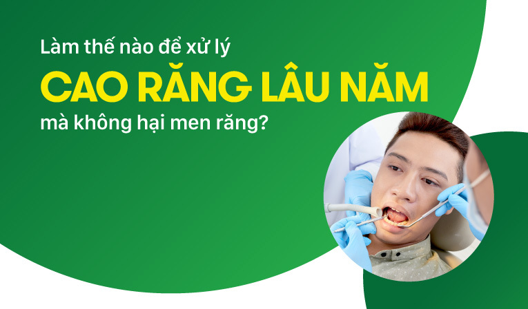 Làm thế nào để xử lý cao răng lâu năm mà không hại men răng?