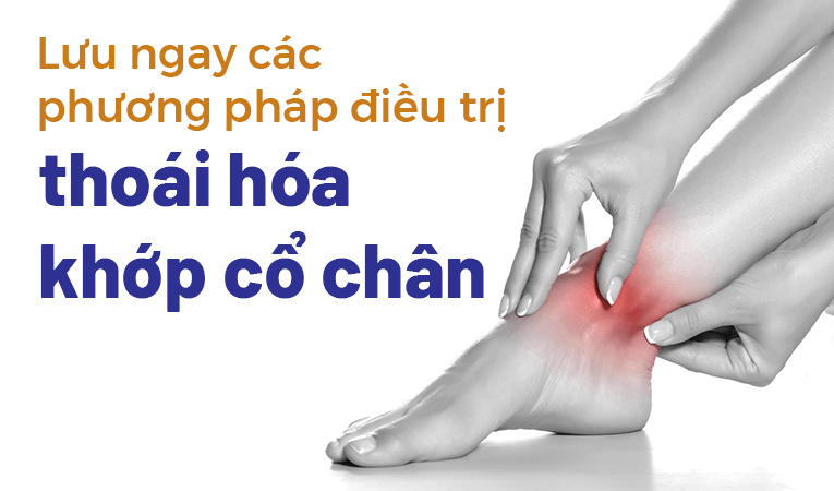 Lưu ngay các phương pháp điều trị thoái hóa khớp cổ chân 