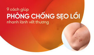 9 cách giúp phòng chống sẹo lồi, nhanh lành vết thương