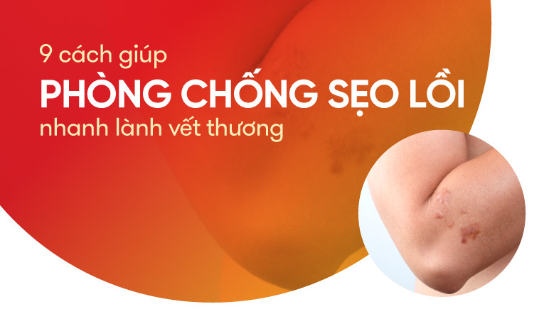 9 cách giúp phòng chống sẹo lồi, nhanh lành vết thương