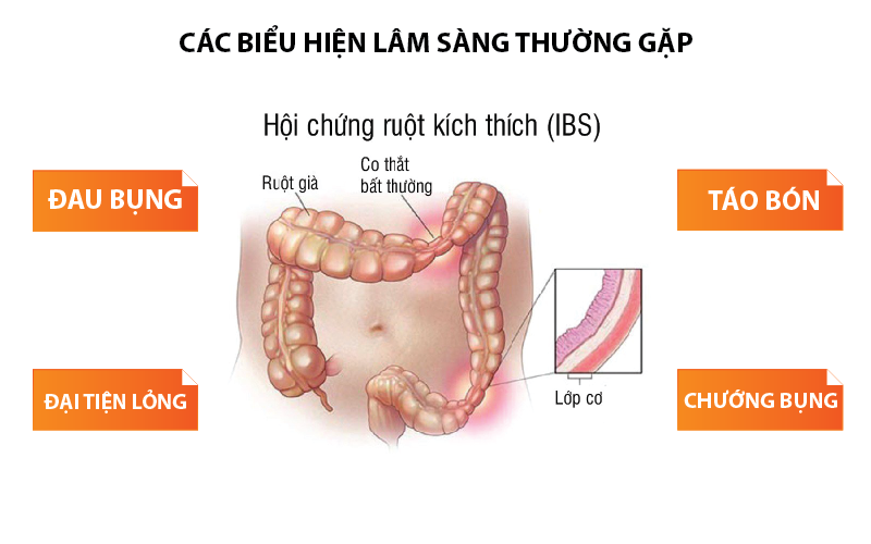 Sôi bụng buồn nôn chán ăn: Dấu hiệu của những bệnh tiêu hóa nào?