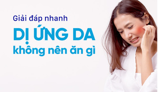 Giải đáp nhanh: Dị ứng da không nên ăn gì?