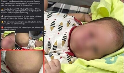 Công an đang xác minh vụ nghi cha ruột bạo hành cháu bé 3 tháng tuổi tại Bình Định
