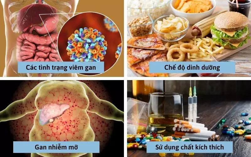 Những nguyên nhân khiến gan bị nóng và cách chữa nóng gan tại nhà