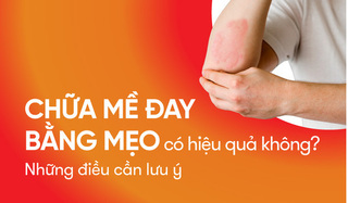 Chữa mề đay bằng mẹo có hiệu quả không? Những điều cần lưu ý