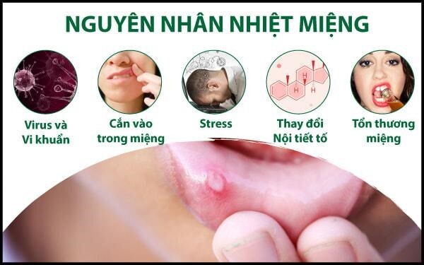 Nhiệt miệng thiếu vitamin gì? Làm thế nào để giảm nhiệt miệng?