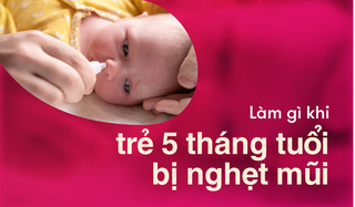 Làm gì khi trẻ 5 tháng tuổi bị nghẹt mũi thường xuyên?