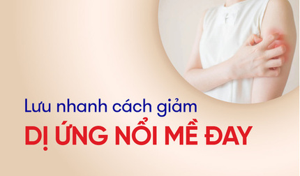 Lưu nhanh cách giảm dị ứng nổi mề đay ngứa ngáy