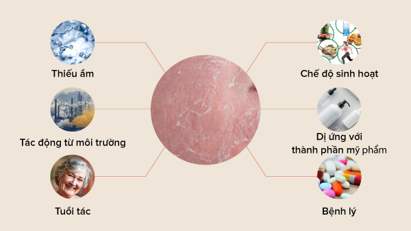 Da khô căng sau khi rửa mặt, phải làm sao để khắc phục?